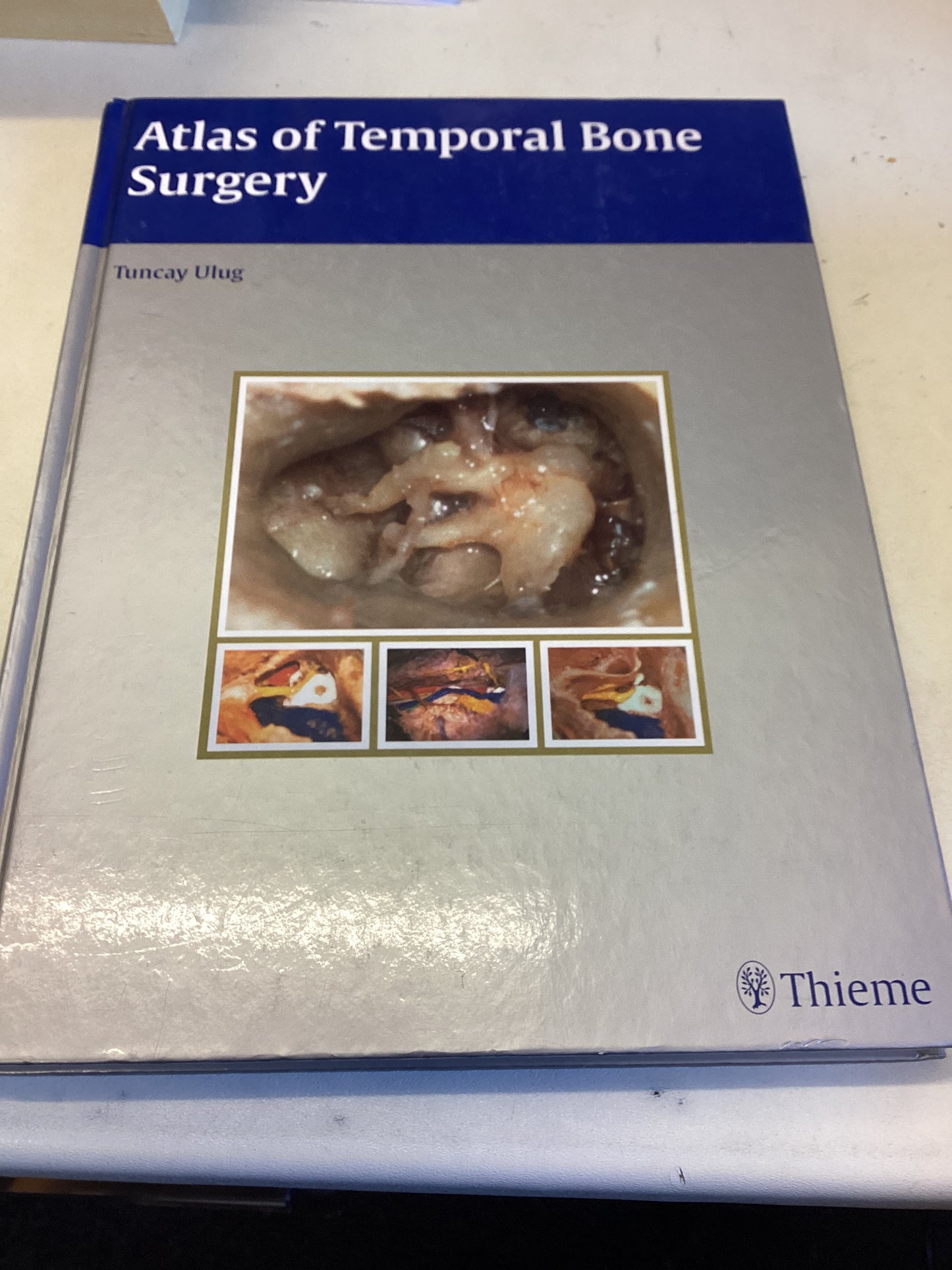 Atlas of Temporal Bone Surgery Tuncay Ulug
